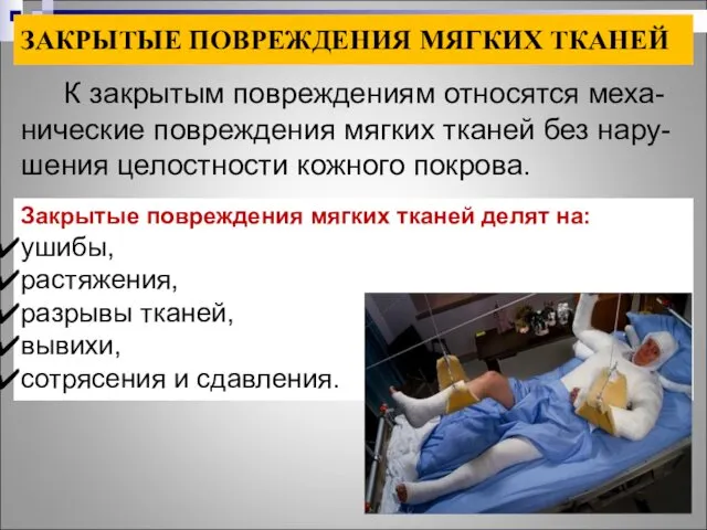 ЗАКРЫТЫЕ ПОВРЕЖДЕНИЯ МЯГКИХ ТКАНЕЙ К закрытым повреждениям относятся меха-нические повреждения мягких тканей без