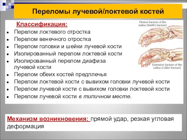 Переломы лучевой/локтевой костей Классификация: Перелом локтевого отростка Перелом венечного отростка Перелом головки и