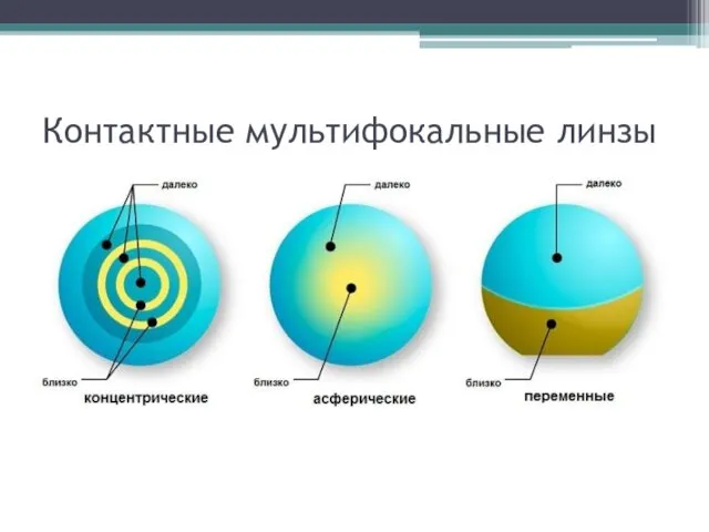 Контактные мультифокальные линзы