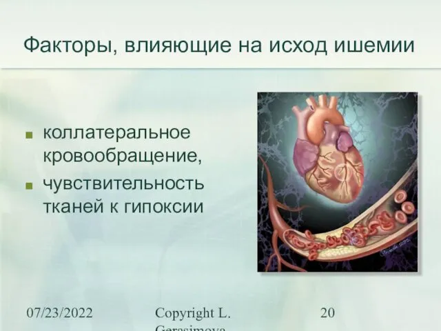 07/23/2022 Copyright L. Gerasimova Факторы, влияющие на исход ишемии коллатеральное кровообращение, чувствительность тканей к гипоксии