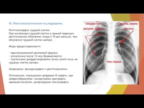 IV. Рентгенологическое исследование. Рентгенография грудной клетки. При экспозиции грудной клетки