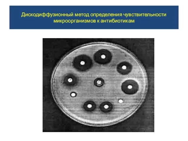 Дискодиффузионный метод определения чувствительности микроорганизмов к антибиотикам