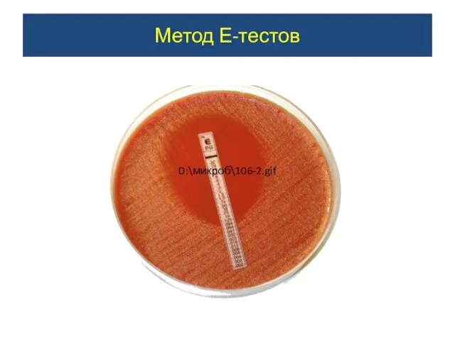 Метод Е-тестов D:\микроб\106-2.gif