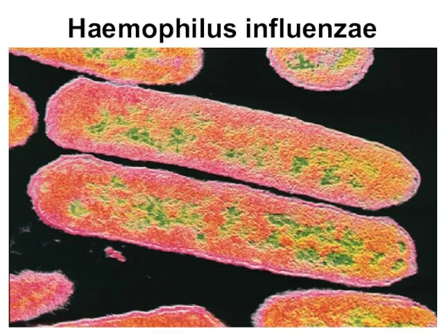 Haemophilus influenzae