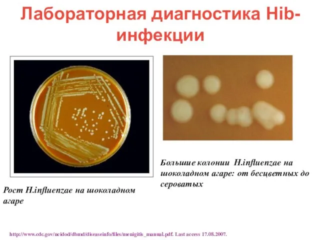 Лабораторная диагностика Hib-инфекции Рост H.influenzae на шоколадном агаре Большие колонии