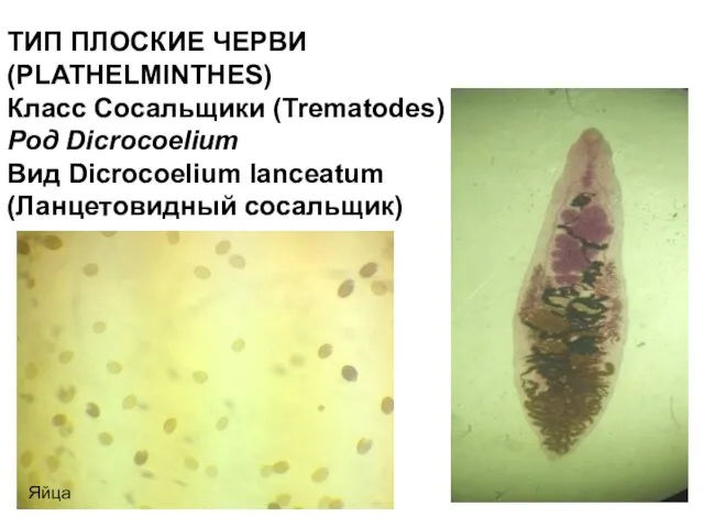 ТИП ПЛОСКИЕ ЧЕРВИ (PLATHELMINTHES) Класс Cосальщики (Trematodes) Род Dicrocoelium Вид Dicrocoelium lanceatum (Ланцетовидный сосальщик) Яйца