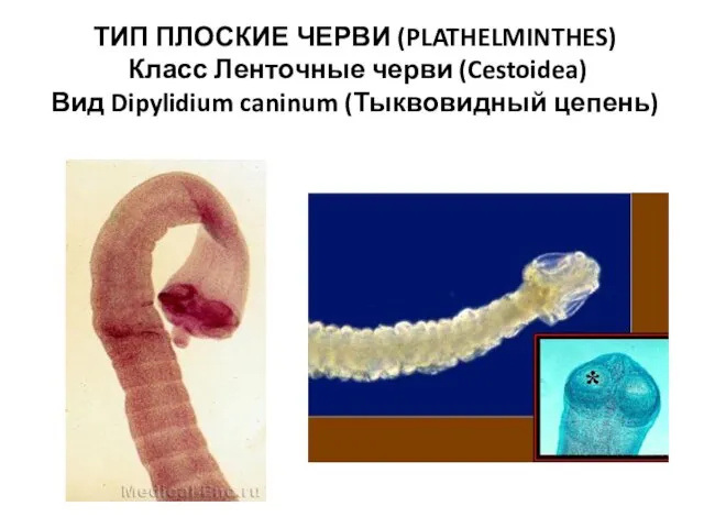 ТИП ПЛОСКИЕ ЧЕРВИ (PLATHELMINTHES) Класс Ленточные черви (Cestoidea) Вид Dipylidium caninum (Тыквовидный цепень)