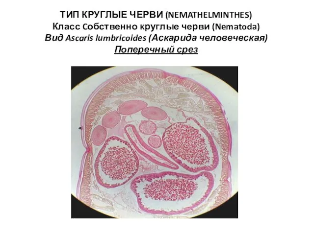ТИП КРУГЛЫЕ ЧЕРВИ (NEMATHELMINTHES) Класс Cобственно круглые черви (Nematoda) Вид Ascaris lumbricoides (Аскарида человеческая) Поперечный срез
