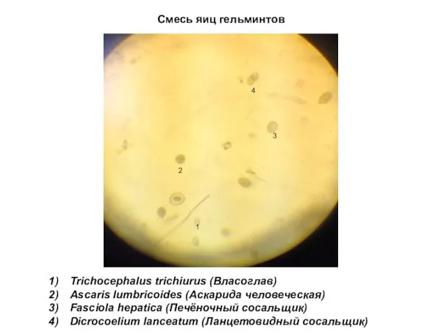 Смесь яиц гельминтов 1 2 4 3 Trichocephalus trichiurus (Власоглав)