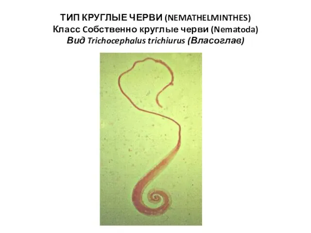 ТИП КРУГЛЫЕ ЧЕРВИ (NEMATHELMINTHES) Класс Cобственно круглые черви (Nematoda) Вид Trichocephalus trichiurus (Власоглав)