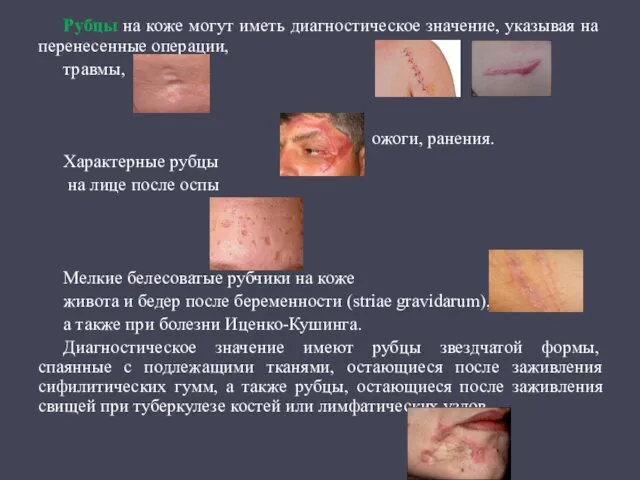 Рубцы на коже могут иметь диагностическое значение, указывая на перенесенные