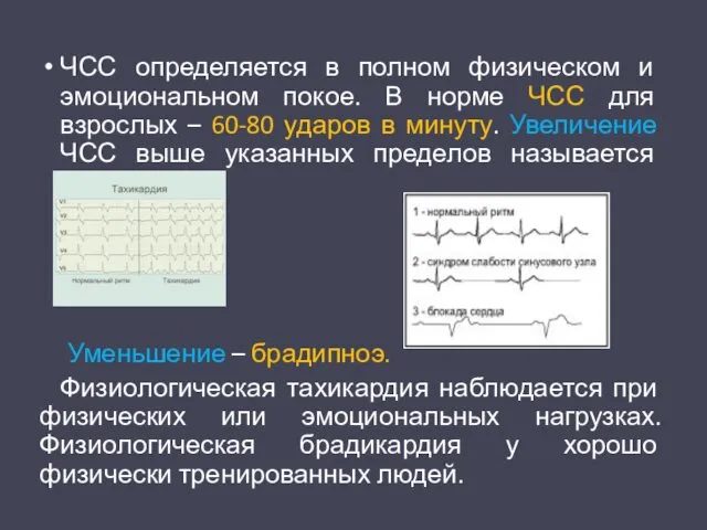 ЧСС определяется в полном физическом и эмоциональном покое. В норме