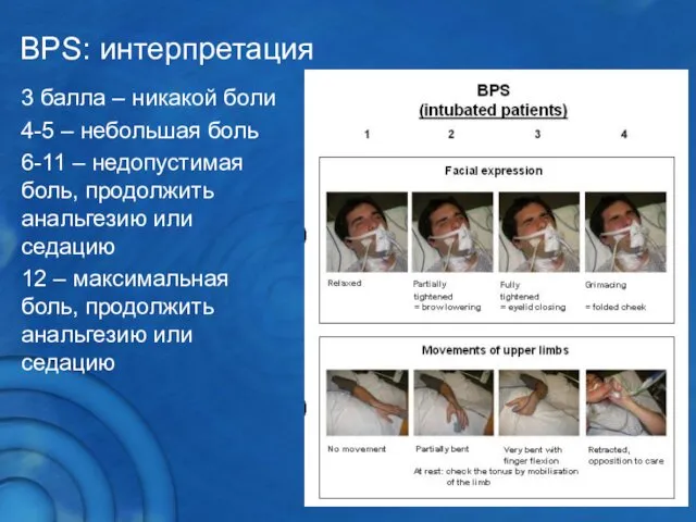 BPS: интерпретация 3 балла – никакой боли 4-5 – небольшая