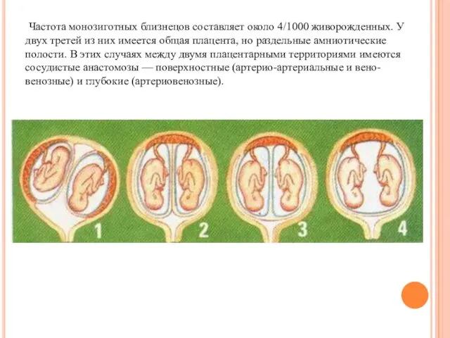 Частота монозиготных близнецов составляет около 4/1000 живорожденных. У двух третей