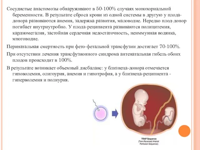 Сосудистые анастомозы обнаруживают в 50-100% случаях монохориальной беременности. В результате