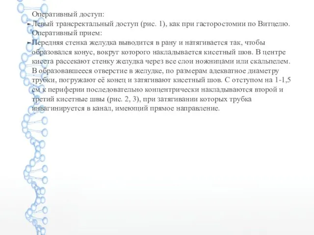 Оперативный доступ: Левый трансректальный доступ (рис. 1), как при гасторостомии