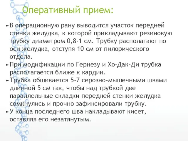 Оперативный прием: В операционную рану выводится участок передней стенки желудка,