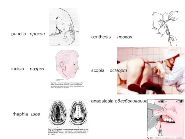 punctio прокол incisio разрез rhaphia шов centhesis прокол scopia осморт anaestesia обезболивание