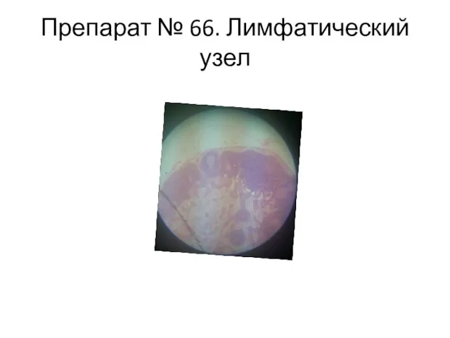 Препарат № 66. Лимфатический узел