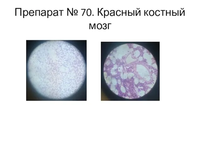 Препарат № 70. Красный костный мозг