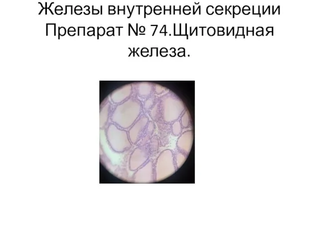 Железы внутренней секреции Препарат № 74.Щитовидная железа.