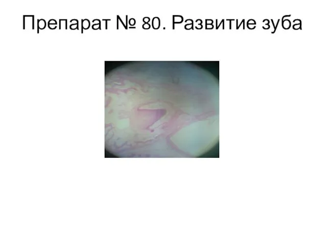 Препарат № 80. Развитие зуба