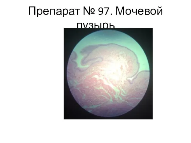 Препарат № 97. Мочевой пузырь