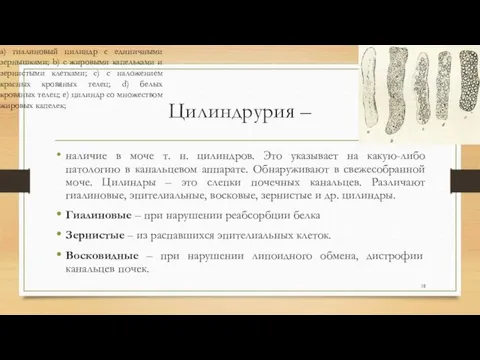 Цилиндрурия – наличие в моче т. н. цилиндров. Это указывает