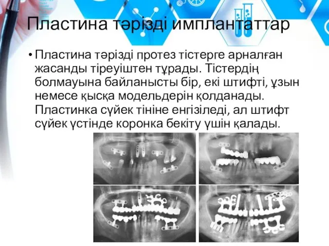 Пластина тәрізді имплантаттар Пластина тәрізді протез тістерге арналған жасанды тіреуіштен