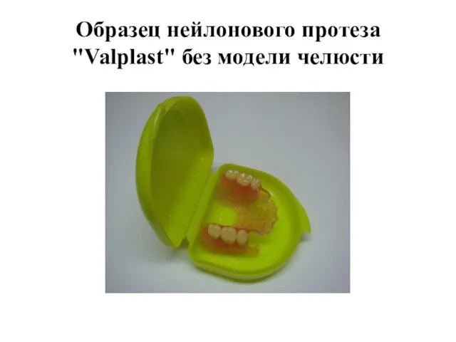 Образец нейлонового протеза "Valplast" без модели челюсти