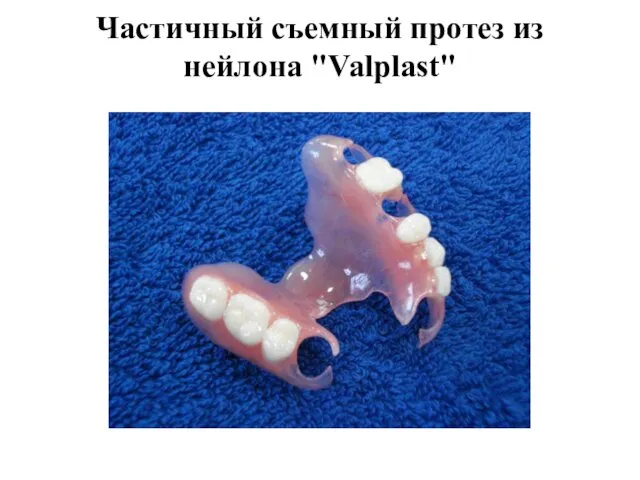 Частичный съемный протез из нейлона "Valplast"