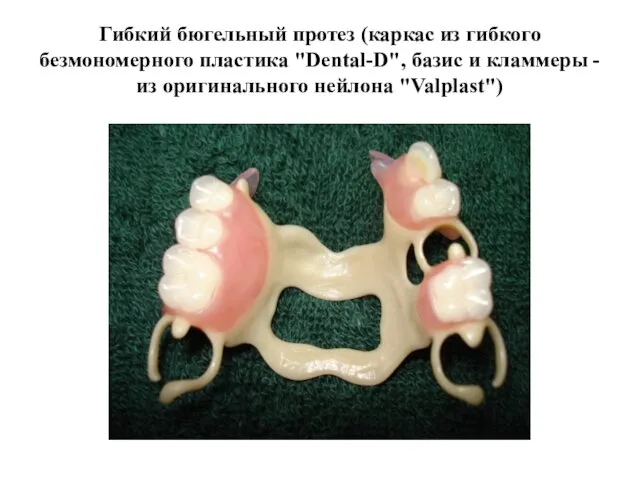 Гибкий бюгельный протез (каркас из гибкого безмономерного пластика "Dental-D", базис