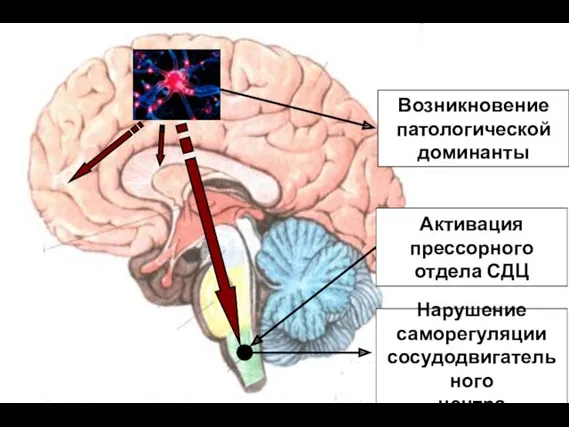 Нарушение саморегуляции сосудодвигательного центра Возникновение патологической доминанты Активация прессорного отдела СДЦ