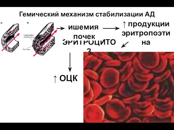 Гемический механизм стабилизации АД ЭРИТРОЦИТОЗ ишемия почек ↑ продукции эритропоэтина ↑ ОЦК