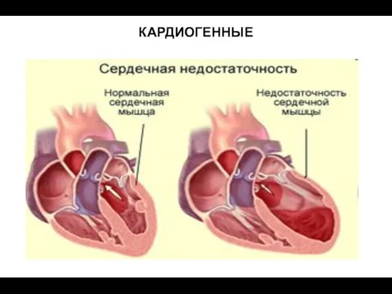 КАРДИОГЕННЫЕ