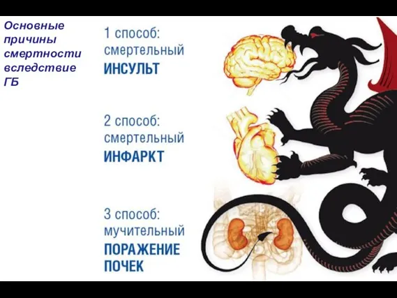 Основные причины смертности вследствие ГБ