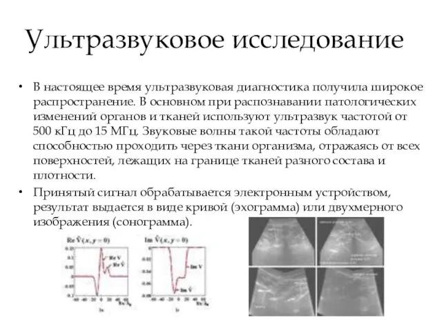 Ультразвуковое исследование В настоящее время ультразвуковая диагностика получила широкое распространение.