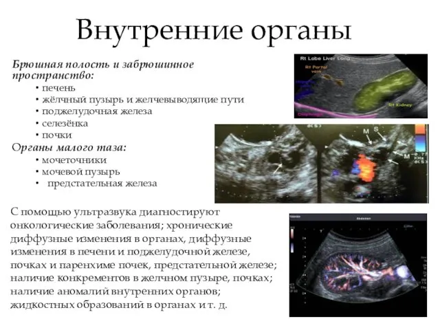 Внутренние органы Брюшная полость и забрюшинное пространство: печень жёлчный пузырь