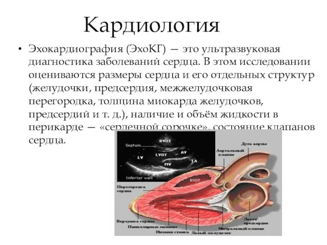 Кардиология Эхокардиография (ЭхоКГ) — это ультразвуковая диагностика заболеваний сердца. В