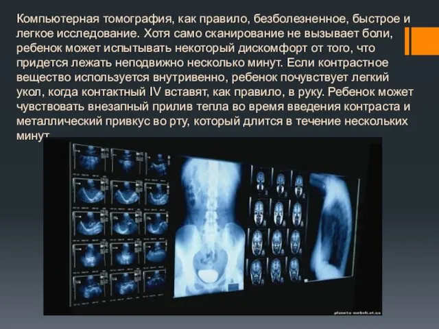 Компьютерная томография, как правило, безболезненное, быстрое и легкое исследование. Хотя