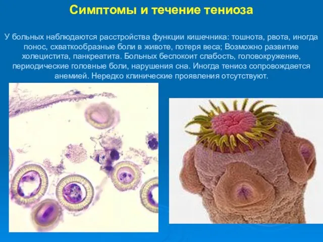 Симптомы и течение тениоза У больных наблюдаются расстройства функции кишечника: