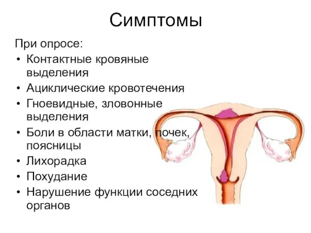 Симптомы При опросе: Контактные кровяные выделения Ациклические кровотечения Гноевидные, зловонные