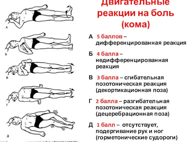 Двигательные реакции на боль (кома) А 5 баллов – дифференцированная