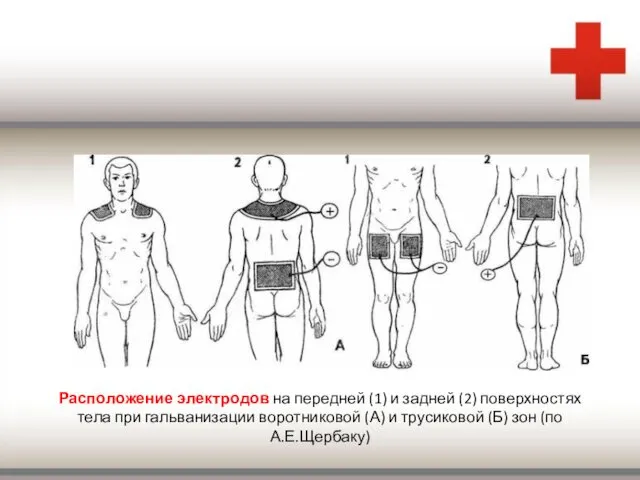 Расположение электродов на передней (1) и задней (2) поверхностях тела