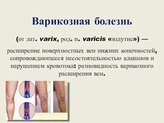 Варикозная болезнь (от лат. varix, род. п. varicis «вздутие») —