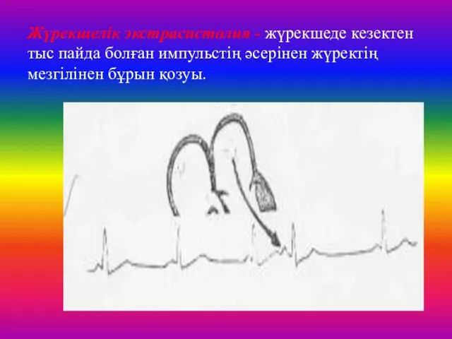 Жүрекшелік экстрасистолия - жүрекшеде кезектен тыс пайда болған импульстің әсерінен жүректің мезгілінен бұрын қозуы.