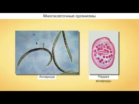 Аскарида Разрез аскариды Многоклеточные организмы