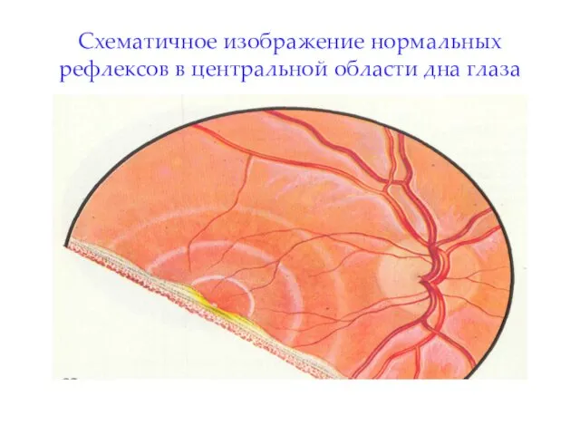 Схематичное изображение нормальных рефлексов в центральной области дна глаза