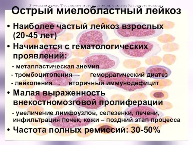 Острый миелобластный лейкоз Наиболее частый лейкоз взрослых (20-45 лет) Начинается