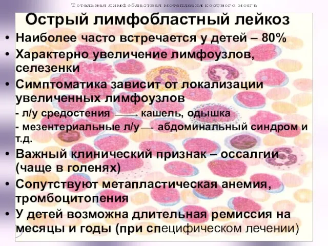 Острый лимфобластный лейкоз Наиболее часто встречается у детей – 80% Характерно увеличение лимфоузлов,